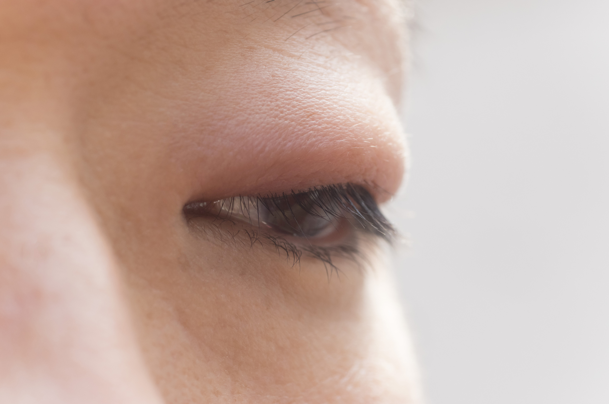 すぐ 治す 目 の 腫れ 目の腫れを治す 7つの方法