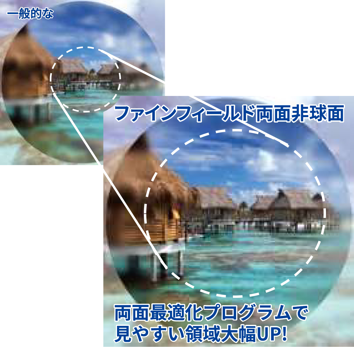 ファインフィールド両面非球面